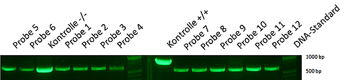 Ist die Insertion in der PV92 Region enthalten, so entsteht nach der PCR ein größeres Fragment. Dies ist in der +/+ Kontrolle im rechten Gel gut zu sehen. Zum Vergleich sehen wir in der Kontrolle -/- ein DNA-Fragment ohne Insertion. Da alle Chromosomen